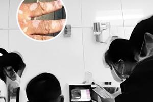 伍德灯下的各种代表什么